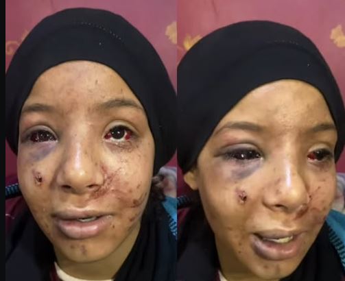 الاعتداء على طفلة بلبيس