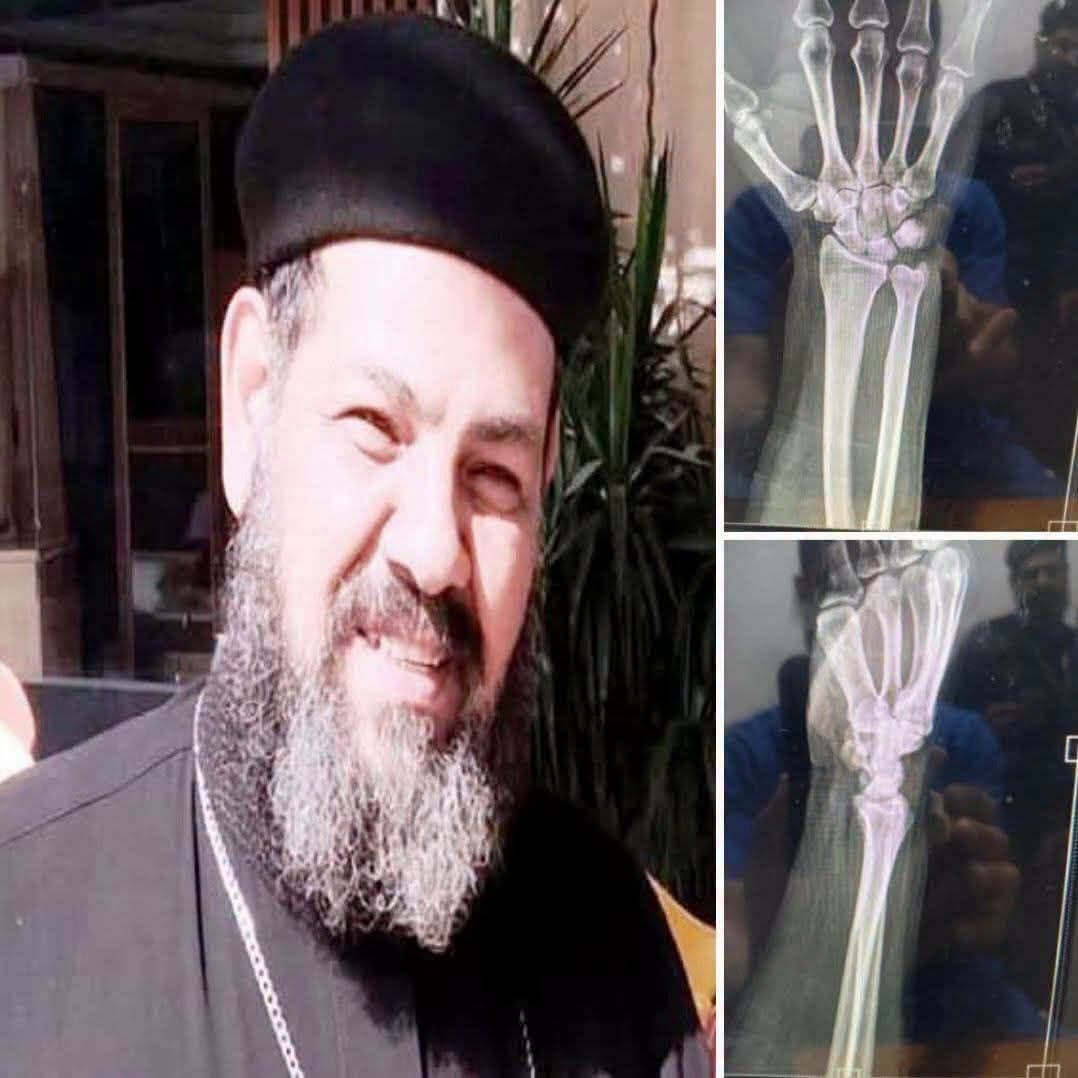 الاعتداء على كاهن مدينة السلام في عين شمس