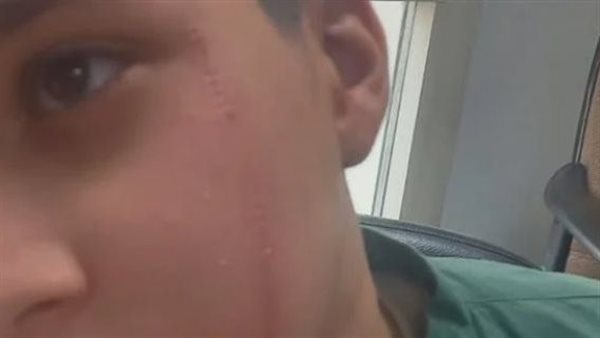 المجني عليه